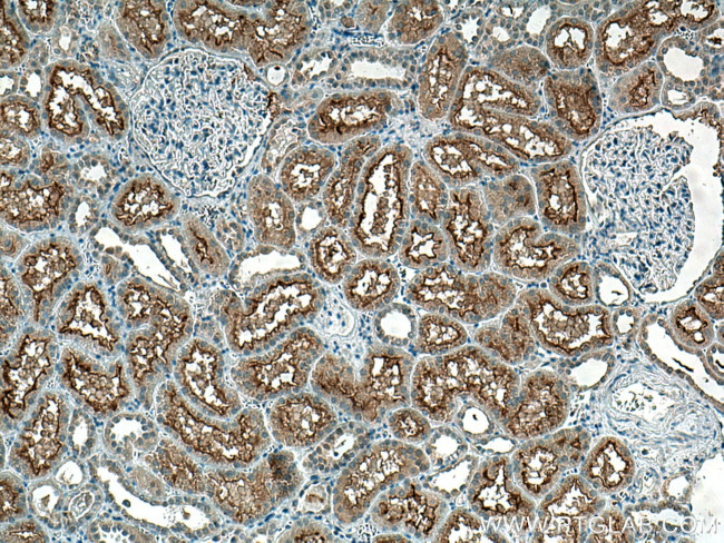 SLC3A1 Antibody in Immunohistochemistry (Paraffin) (IHC (P))