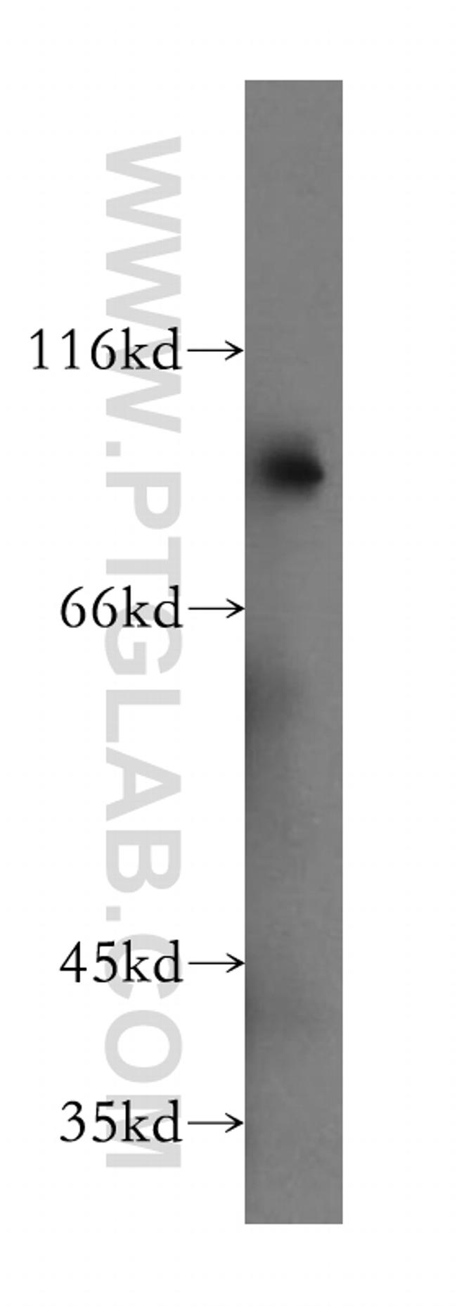 SLC3A1 Antibody in Western Blot (WB)