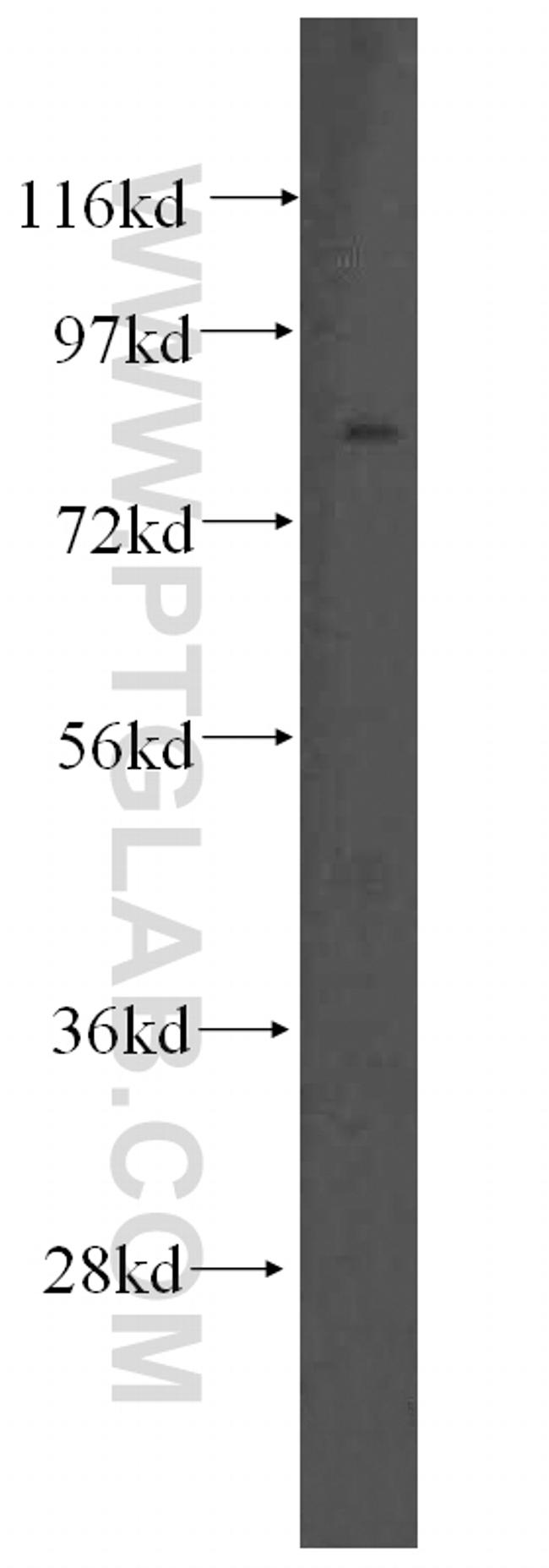 SLC3A1 Antibody in Western Blot (WB)