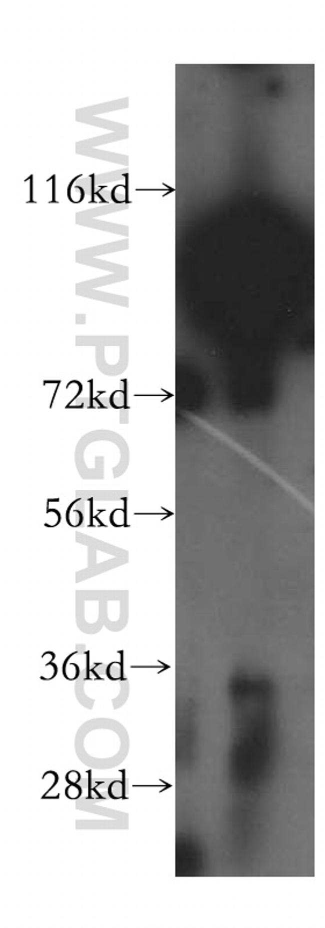 SLC3A1 Antibody in Western Blot (WB)