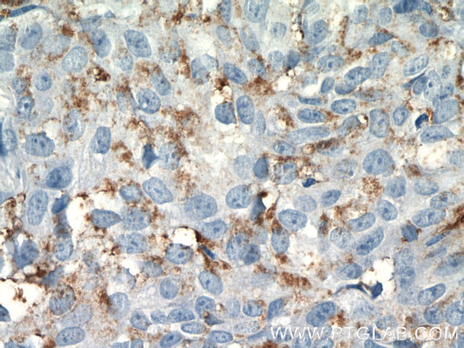 AGER Antibody in Immunohistochemistry (Paraffin) (IHC (P))