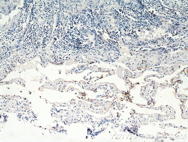 AGER Antibody in Immunohistochemistry (Paraffin) (IHC (P))