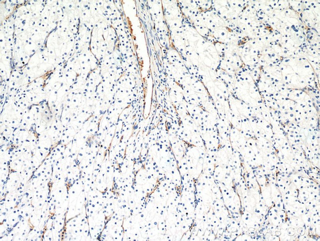 AGER Antibody in Immunohistochemistry (Paraffin) (IHC (P))