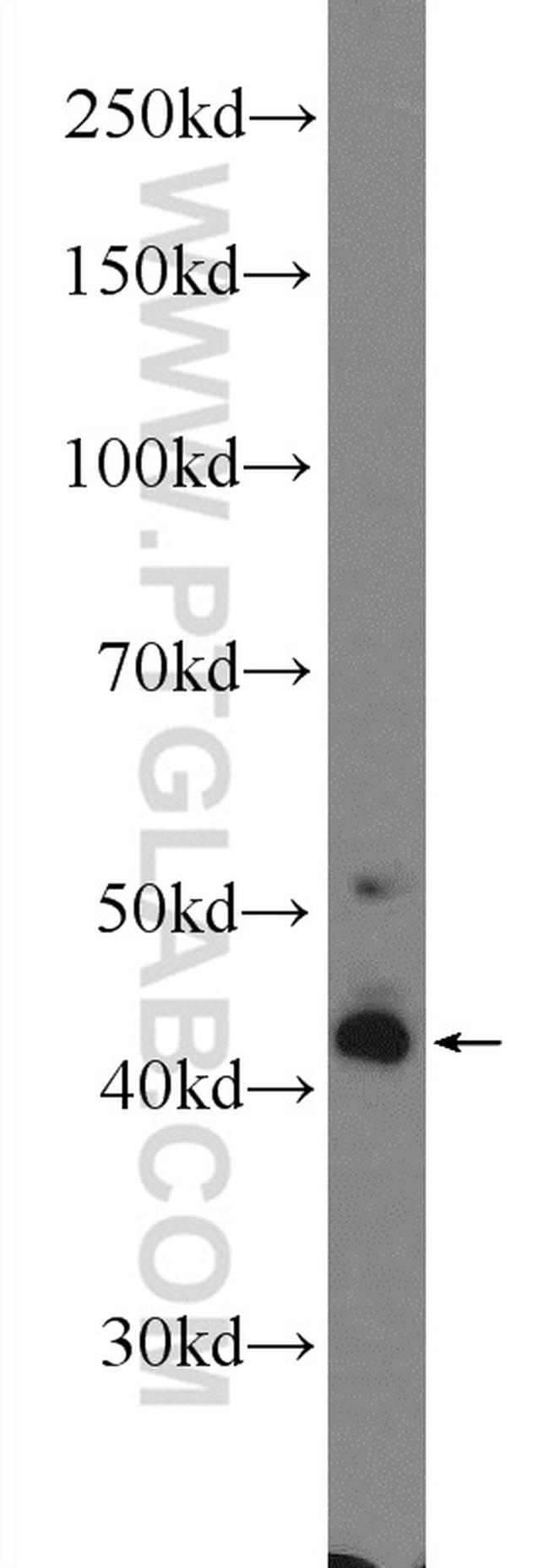 AGER Antibody in Western Blot (WB)