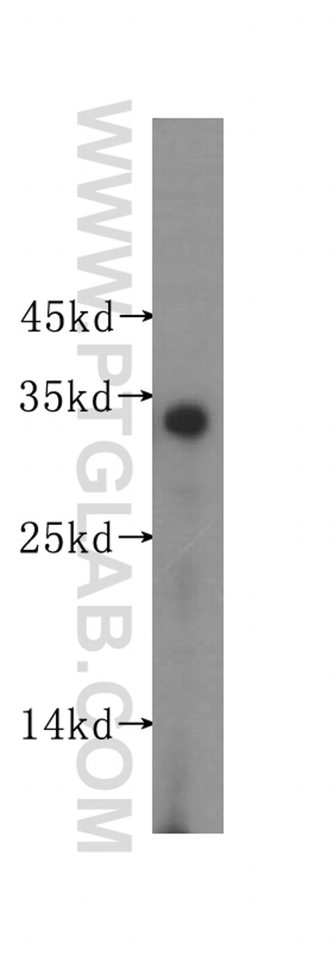 SULT2A1 Antibody in Western Blot (WB)