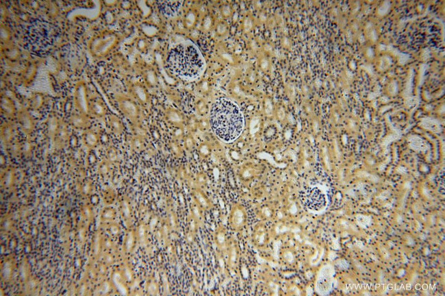 PSG11 Antibody in Immunohistochemistry (Paraffin) (IHC (P))