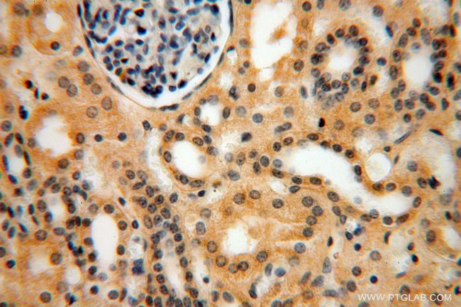 PSG11 Antibody in Immunohistochemistry (Paraffin) (IHC (P))