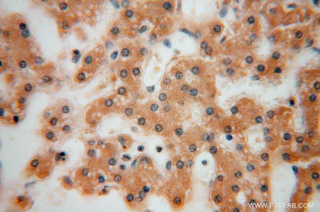 PSG11 Antibody in Immunohistochemistry (Paraffin) (IHC (P))