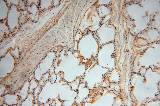 PSG11 Antibody in Immunohistochemistry (Paraffin) (IHC (P))