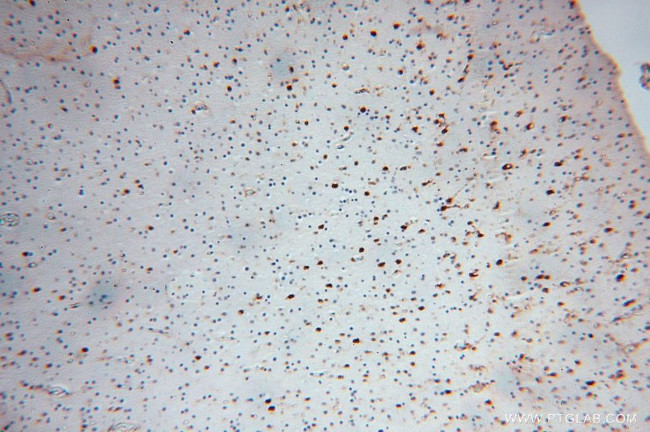 PSG11 Antibody in Immunohistochemistry (Paraffin) (IHC (P))