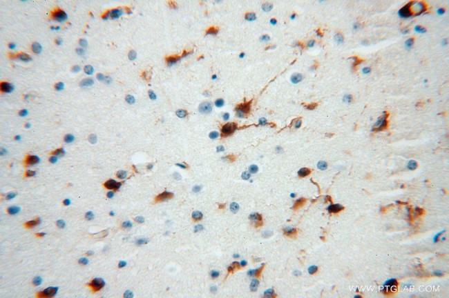 PSG11 Antibody in Immunohistochemistry (Paraffin) (IHC (P))