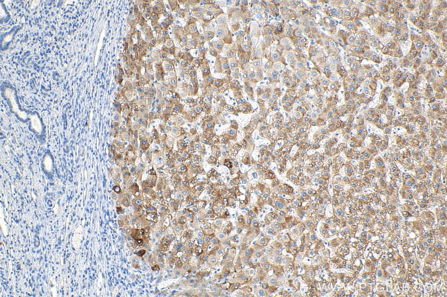 BLZF1 Antibody in Immunohistochemistry (Paraffin) (IHC (P))