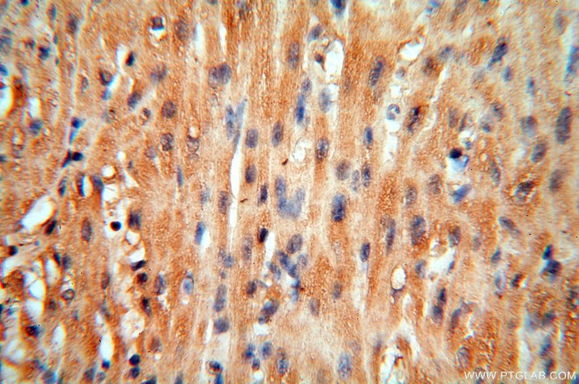 cyclin I Antibody in Immunohistochemistry (Paraffin) (IHC (P))