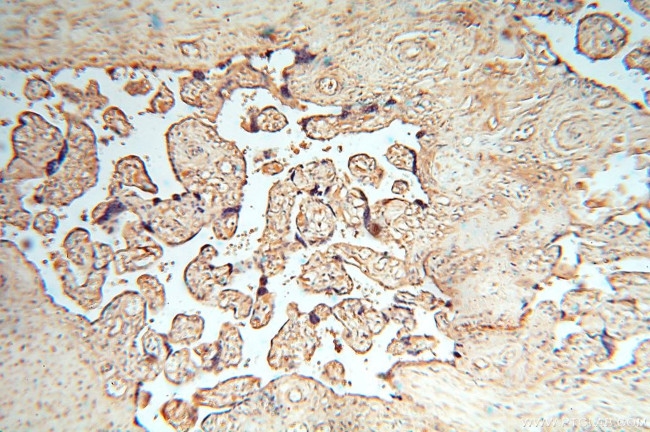 cyclin I Antibody in Immunohistochemistry (Paraffin) (IHC (P))