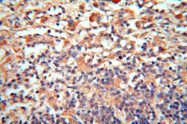 cyclin I Antibody in Immunohistochemistry (Paraffin) (IHC (P))