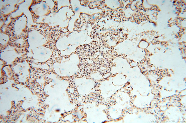 cyclin I Antibody in Immunohistochemistry (Paraffin) (IHC (P))