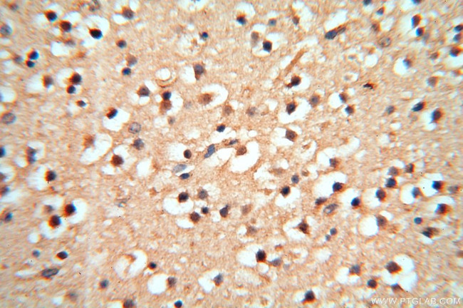 cyclin I Antibody in Immunohistochemistry (Paraffin) (IHC (P))