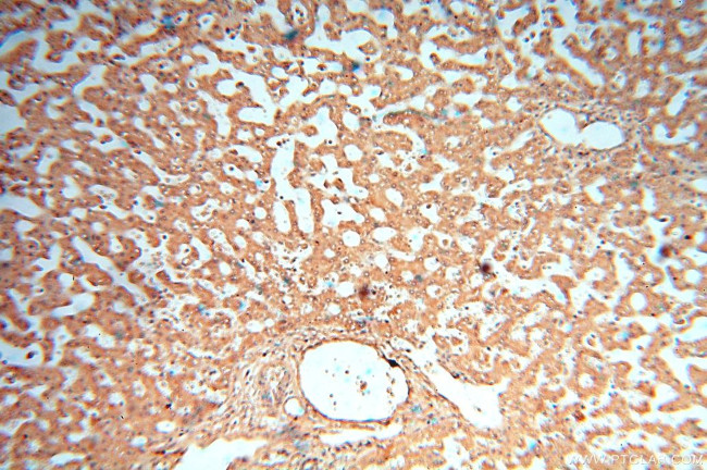 cyclin I Antibody in Immunohistochemistry (Paraffin) (IHC (P))