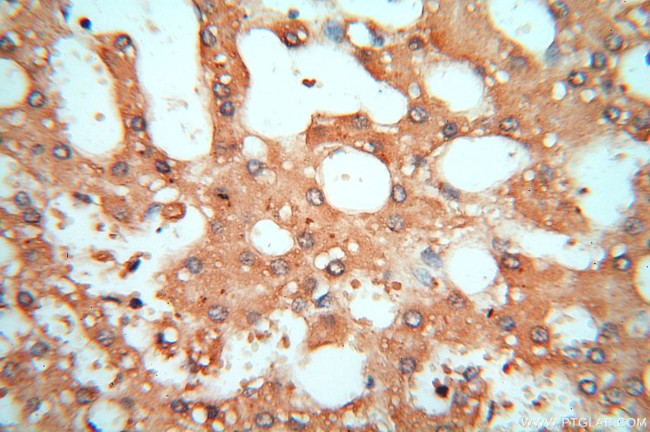 cyclin I Antibody in Immunohistochemistry (Paraffin) (IHC (P))