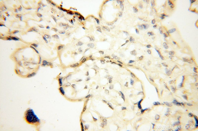 MRPS21 Antibody in Immunohistochemistry (Paraffin) (IHC (P))