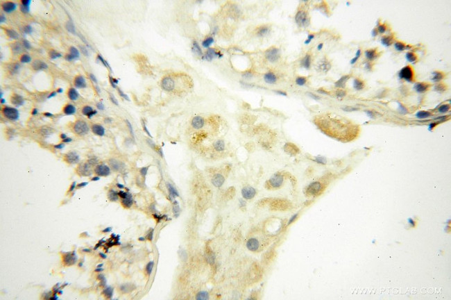 MRPS21 Antibody in Immunohistochemistry (Paraffin) (IHC (P))