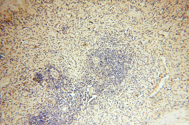 MRPS21 Antibody in Immunohistochemistry (Paraffin) (IHC (P))