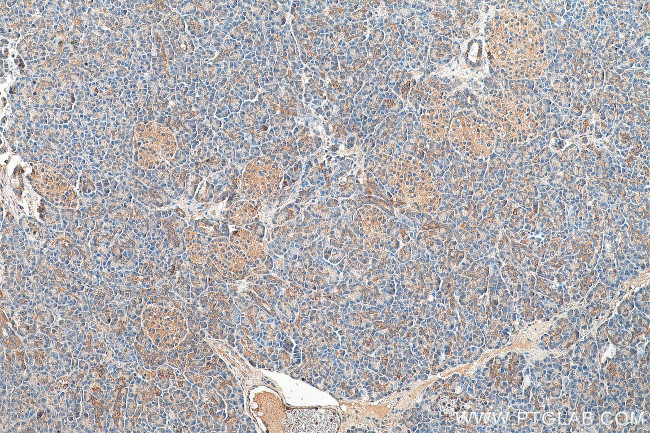 MRPS21 Antibody in Immunohistochemistry (Paraffin) (IHC (P))