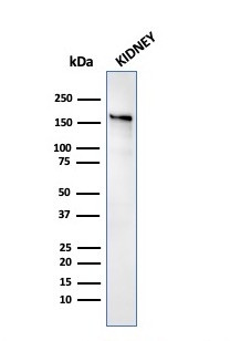 Angiotensin I Converting Enzyme (ACE)/CD143 Antibody in Western Blot (WB)