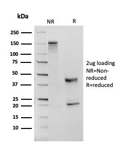 Angiotensin I Converting Enzyme (ACE)/CD143 Antibody in SDS-PAGE (SDS-PAGE)