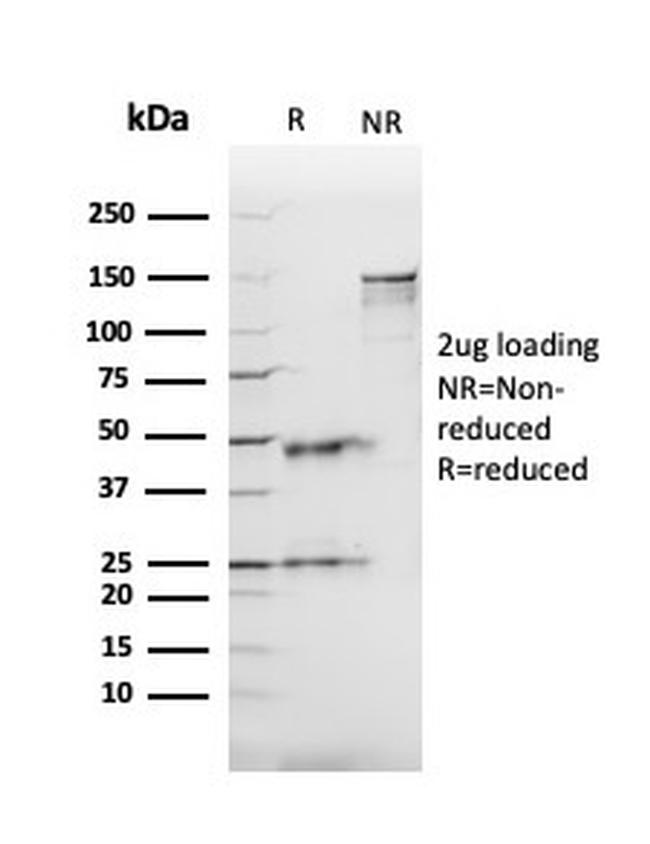 Angiotensin I Converting Enzyme (ACE)/CD143 Antibody in SDS-PAGE (SDS-PAGE)
