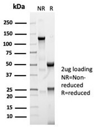 Angiotensin I Converting Enzyme (ACE)/CD143 Antibody in SDS-PAGE (SDS-PAGE)