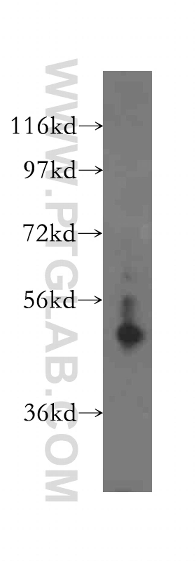 TXNRD2 Antibody in Western Blot (WB)