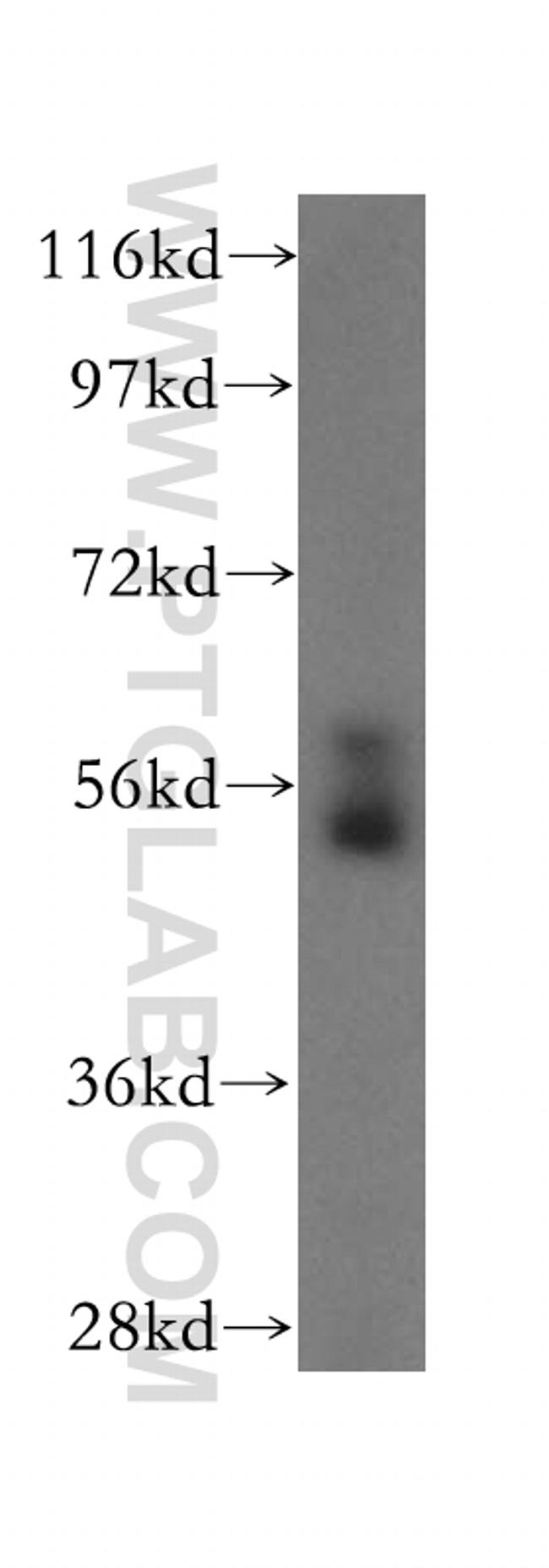 TXNRD2 Antibody in Western Blot (WB)