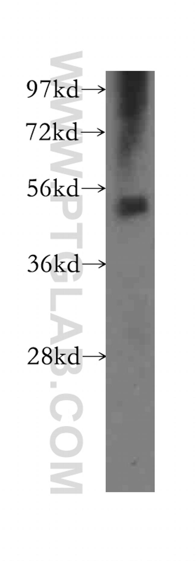 TXNRD2 Antibody in Western Blot (WB)