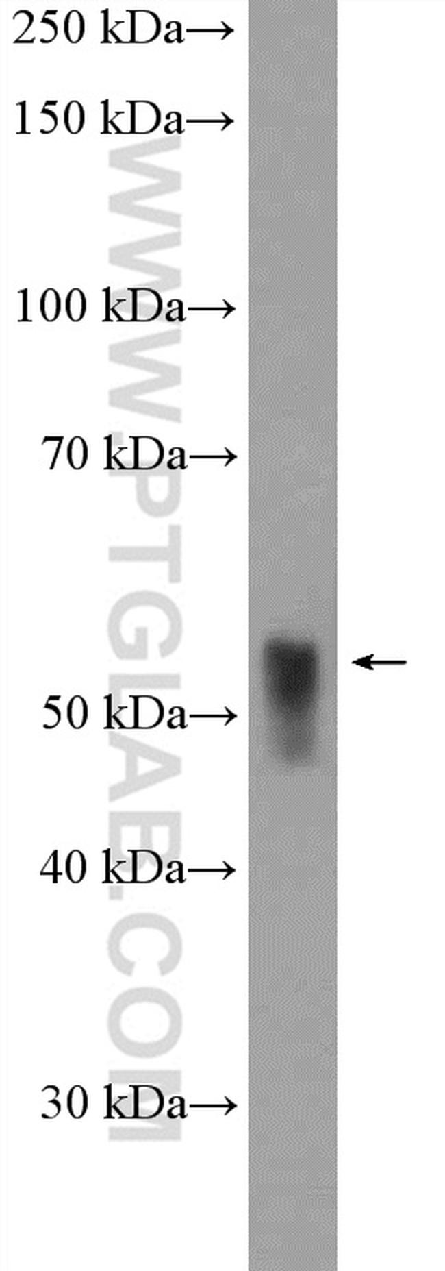 TXNRD2 Antibody in Western Blot (WB)