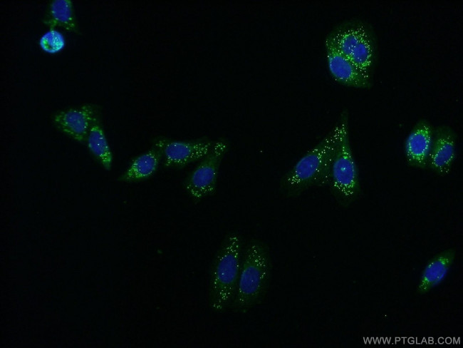 TXNRD2 Antibody in Immunocytochemistry (ICC/IF)