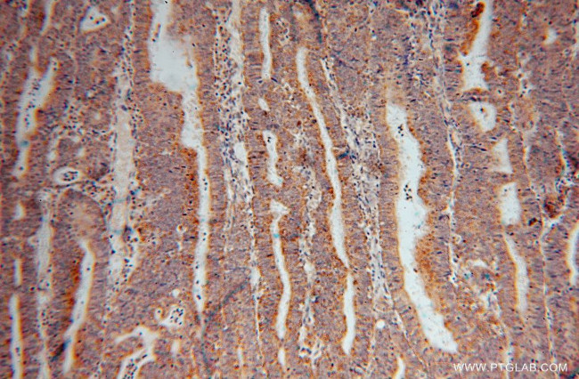 TXNRD2 Antibody in Immunohistochemistry (Paraffin) (IHC (P))