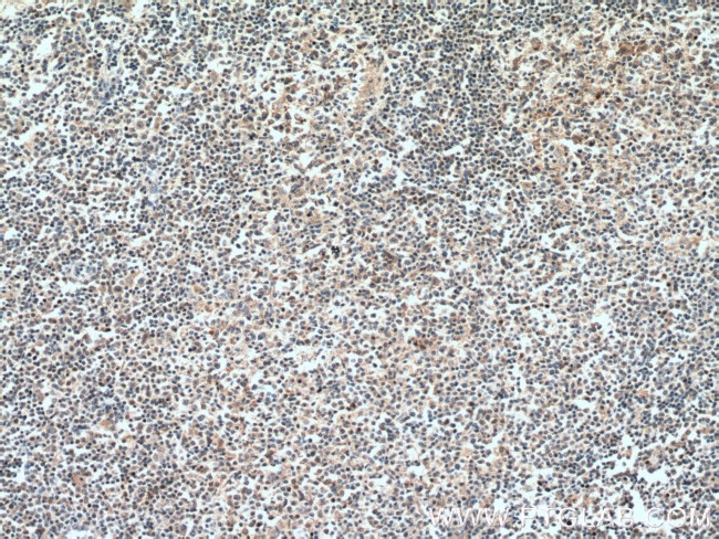 VAV1 Antibody in Immunohistochemistry (Paraffin) (IHC (P))