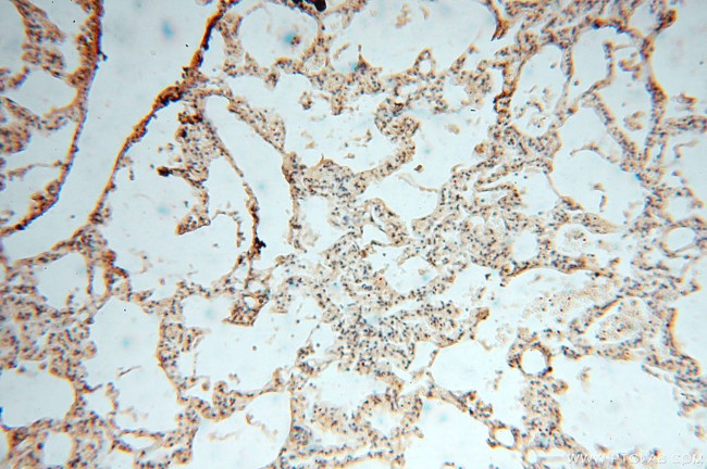 VAV1 Antibody in Immunohistochemistry (Paraffin) (IHC (P))