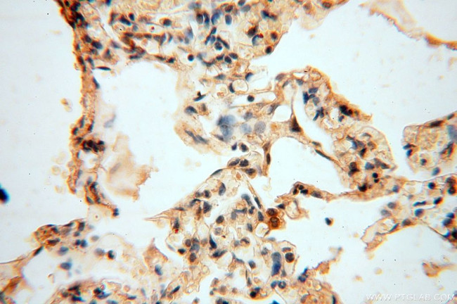 VAV1 Antibody in Immunohistochemistry (Paraffin) (IHC (P))