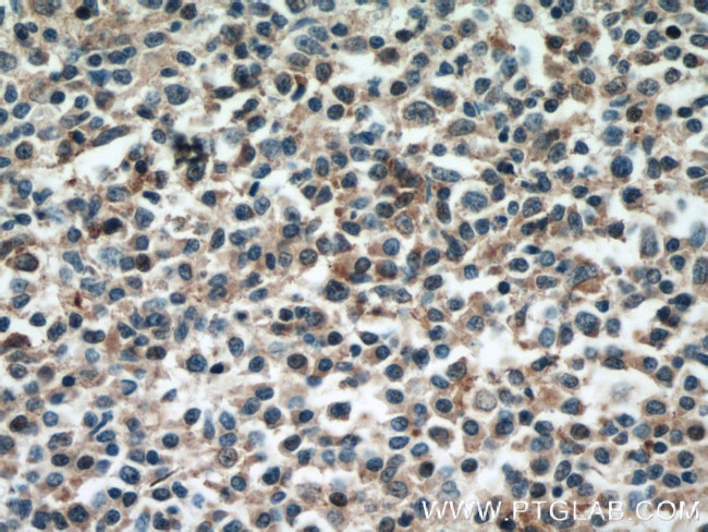 VAV1 Antibody in Immunohistochemistry (Paraffin) (IHC (P))