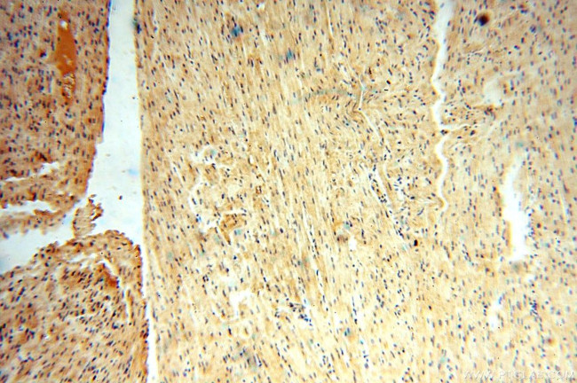 VAV1 Antibody in Immunohistochemistry (Paraffin) (IHC (P))