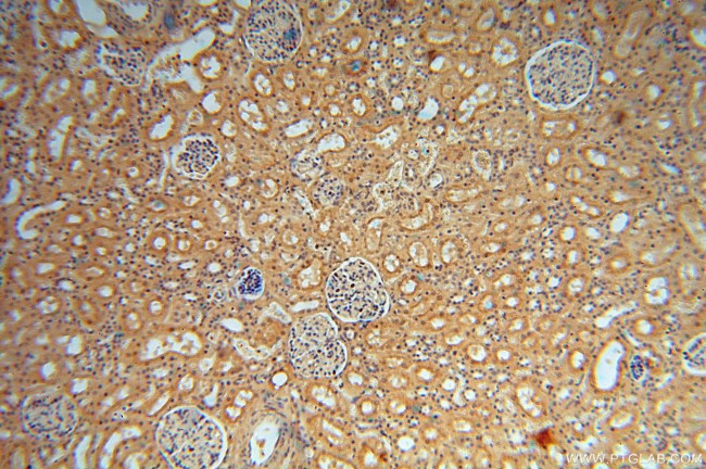 VAV1 Antibody in Immunohistochemistry (Paraffin) (IHC (P))