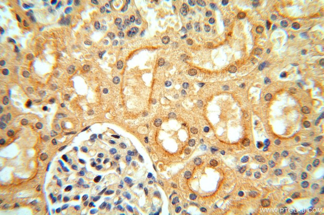 VAV1 Antibody in Immunohistochemistry (Paraffin) (IHC (P))