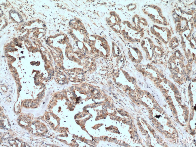 VAV1 Antibody in Immunohistochemistry (Paraffin) (IHC (P))