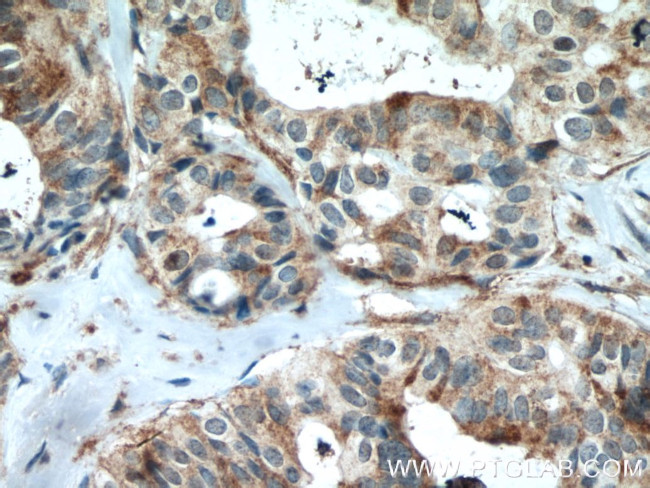 VAV1 Antibody in Immunohistochemistry (Paraffin) (IHC (P))