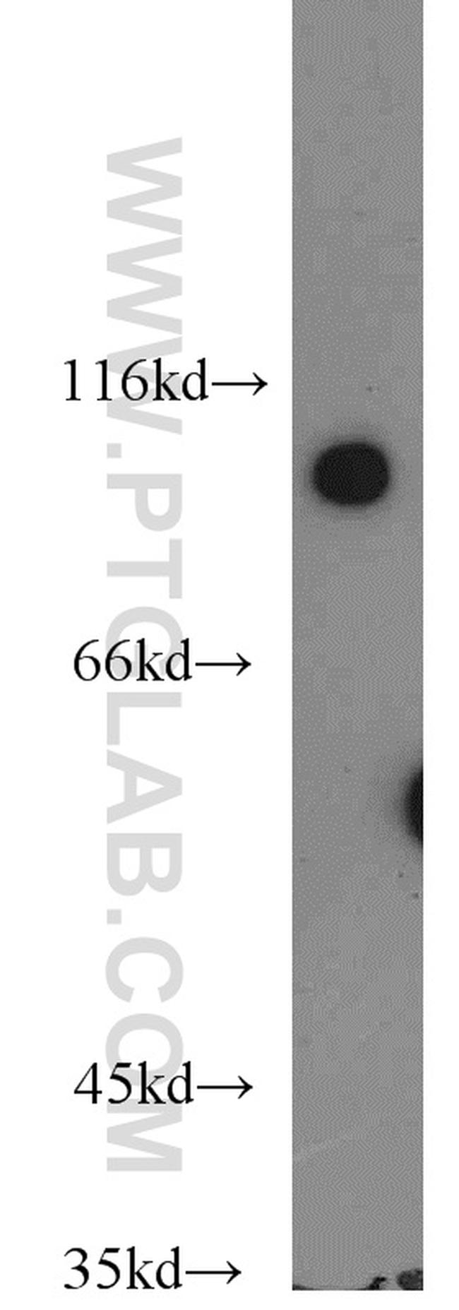 VAV1 Antibody in Western Blot (WB)