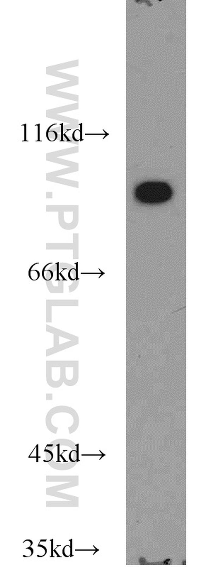 VAV1 Antibody in Western Blot (WB)