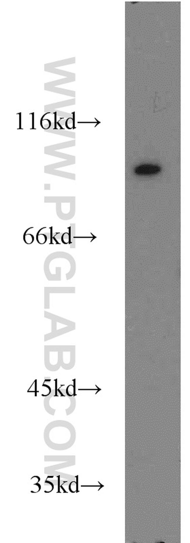 VAV1 Antibody in Western Blot (WB)