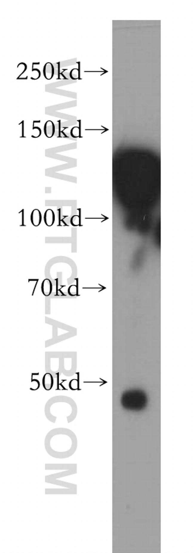 HNRNPU Antibody in Western Blot (WB)